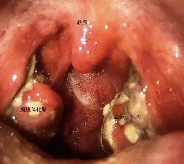 1691313666406.jpg 1691313666406.jpg