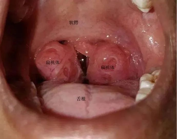 1691313687964.jpg 1691313687964.jpg