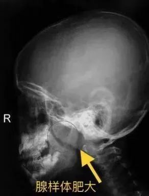 1691313926901.jpg 1691313926901.jpg